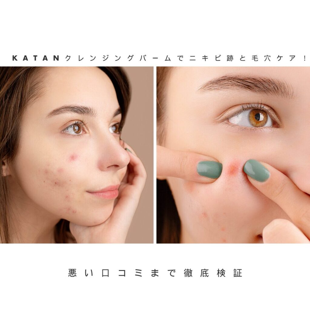 katanクレンジングバーム ニキビ跡