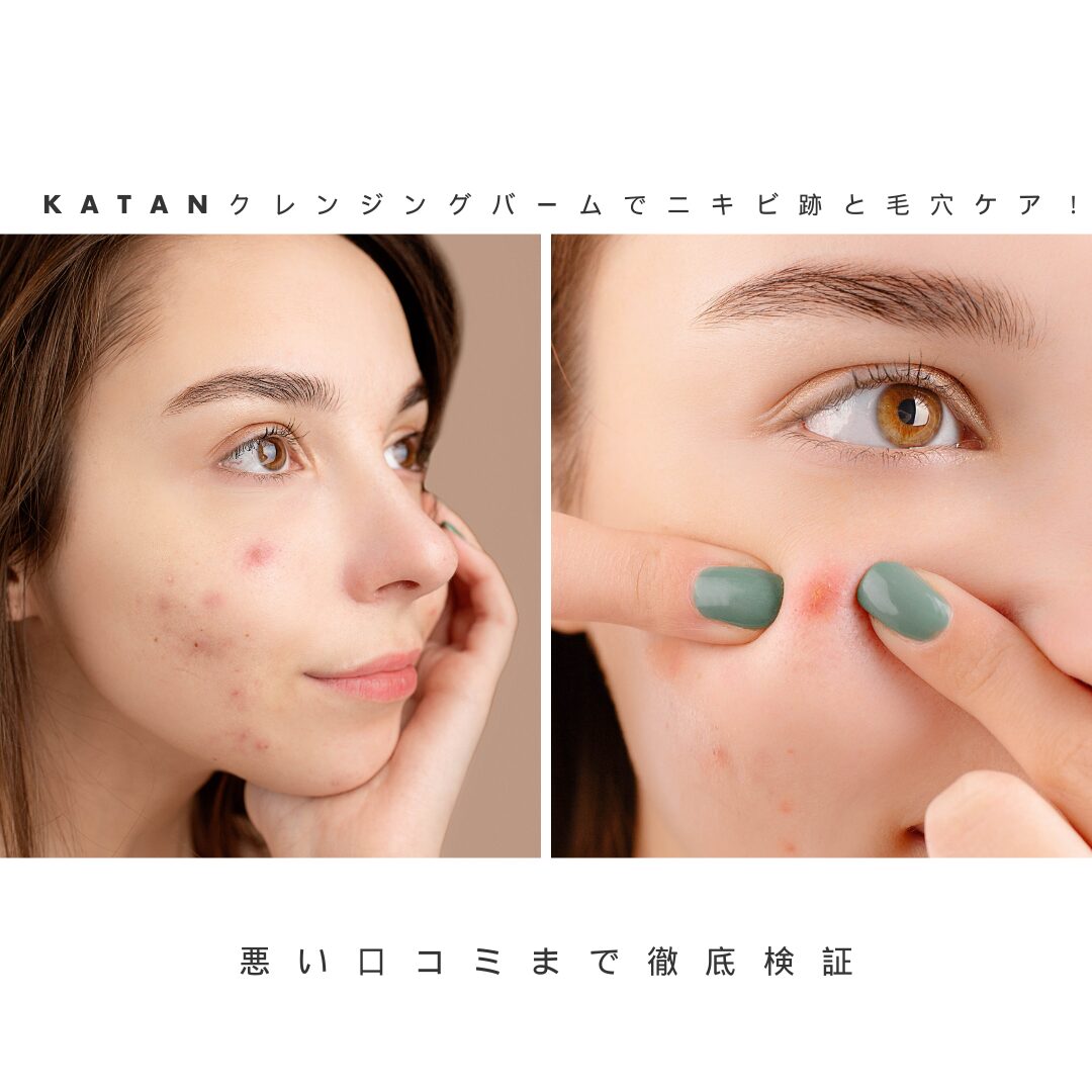 katanクレンジングバーム ニキビ跡